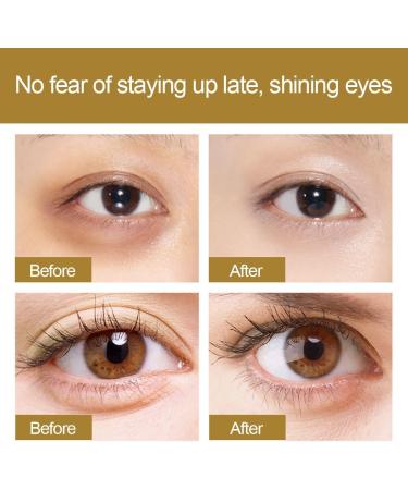 Eye Repair Cream Eye Cream Anti Wrinkle Eye Cream Under Eye Roller Cream Eye Tightening Lifting Serum Eye Cream for Dark Circles and Puffy Eyes Eye Bags Remover and Anti Wrinkle 25ml - Buy Online on GoSupps.com
