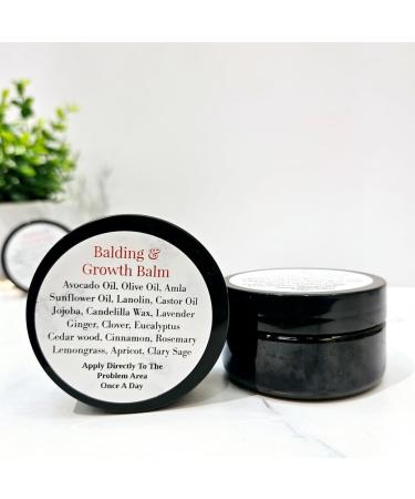 Natural Rapid Growth Grease Balding Balm Fast Hair Growth Helps Hair Loss Dandruff