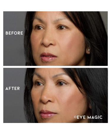 Eye Magic Premium Instant Eyelid Lift (L/XL Kit w/Gel) | Lifts Droopy, Sagging Hooded Eyelids for Youthful Look | Made in America - Buy Online on GoSupps.com