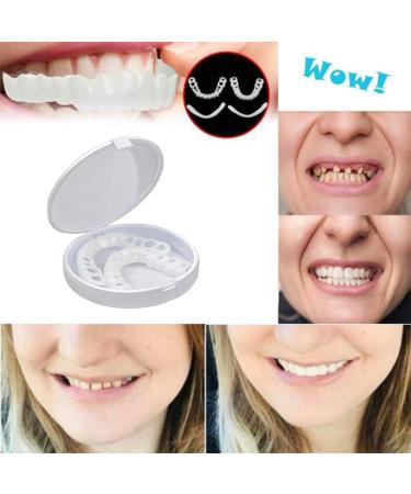 Snap-On Denture Smile Braces for Men and Women - Enhance Your Smile! - Buy Online on GoSupps.com