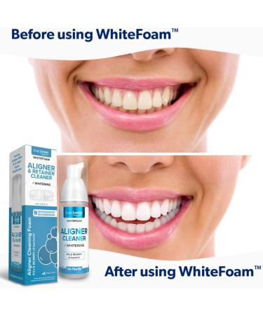 WhiteFoam On-The-Go Clear Retainer Cleaner | Kills Bacteria, Whitens Teeth | For Invisalign, Dentures, ClearCorrect | 50ml - Buy Online on GoSupps.com