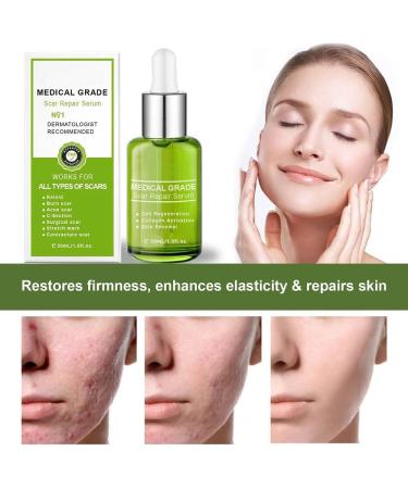 flysmus Advanced Scar Repair Serum - Medical Grade Spray for All Types of Scars (1PCS) - Buy Online on GoSupps.com