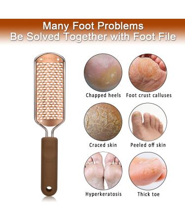 Pedicure Foot File Callus Remover - Stainless Steel Professional Foot Grater for Feet - Dead Skin Scrubber - Wet & Dry Feet - 1pcs - Buy Online on GoSupps.com