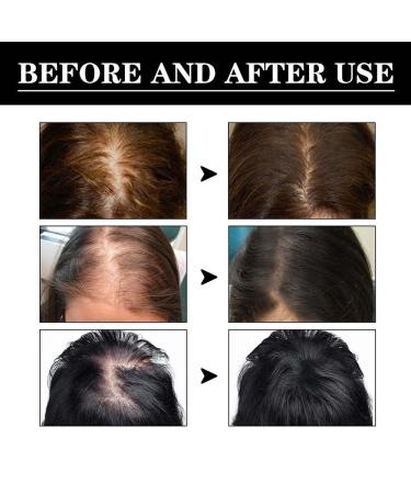 Alopecia Hair Growth Oil for Women & Men | Natural Hair Loss Treatment Serum | Fast-Acting Vegan Scalp Fertilizer - Buy Online on GoSupps.com