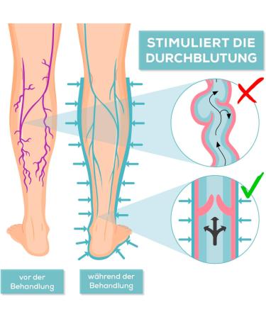 Venenwalker Basic Vein Therapy - Certified Medical Device for Vein Health | Effective Relief for Lipedema Lymphedema & Post-Sports Regeneration - Buy Online on GoSupps.com