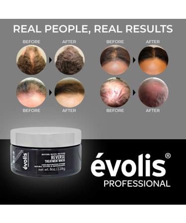 Volis Reverse Hair Mask for Growth & Repair - Deep Conditioning Treatment for Color Treated Hair (8.5 fl oz) - Buy Online on GoSupps.com