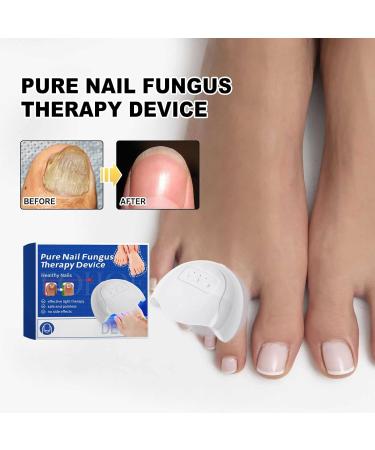 Furzero Pureail Nail Fungus Laser Therapy Device - Effective Fungus Treatment for Healthy Nails | Fast International Shipping - Buy Online on GoSupps.com