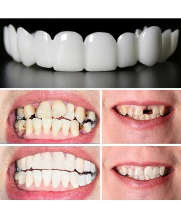 Fluktrix Instant Veneers - 2 Pairs of Cosmetic Temporary Smile Teeth for Upper & Lower Teeth - International Shipping - Buy Online on GoSupps.com