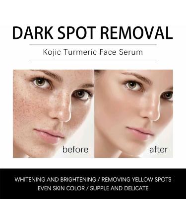  Hongjingda Turmeric - Liquid Dark Spot Removal | 1.01 FL oz Rejuvenating Skin Care for Women Moisturizes Dull and Dry Skin - Buy Online on GoSupps.com