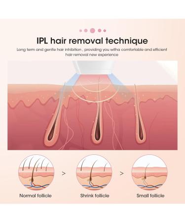 IPL Hair Remover Mini Home Laser - 500,000 Flashes, 5 Energy Gears - Body Face Bikini Area - Portable Lightweight - Gifts for Women and Men (White) - Buy Online on GoSupps.com