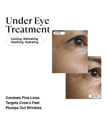 MATKAS Korean Retinol Eye Cream - Anti Aging Solution for Dark Circles Puffiness Wrinkles | Niacinamide Turmeric Ceramides & Hyaluronic Acid - Buy Online on GoSupps.com