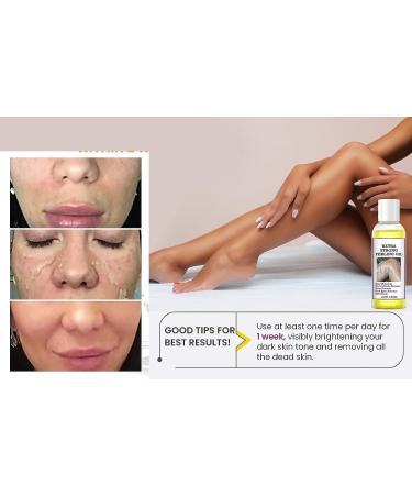 Extra Strength Yellow Peeling Oil | Exfoliating Solution for All Skin Types - Dark Skin Dead Skin Remover (3.87 Fl Oz / 110ML - Buy Online on GoSupps.com