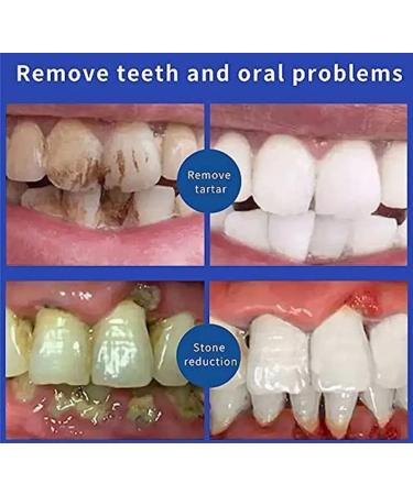 SP-6 Ultra Whitening Probiotic Toothpaste | Fresh Breath & Stain Removal | 6 Tooth Paste for Brightening | International Shipping Available - Buy Online on GoSupps.com