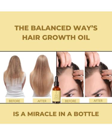Hair Growth Oil (50ml) | Stimulating 100% Natural Unisex Hair Thickening Oil | Targets Hair Loss Nourishes Scalp & Boosts Growth | With Rosemary Oil Biotin Argan Oil Castor Oil & Coconut Oil - Buy Online on GoSupps.com