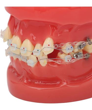 Buy Ververt Touch Ceramic Dental Orthodontic Bracket Model - 24 Teeth Demo Model for Teacher Training | International Shipping Available - Buy Online on GoSupps.com