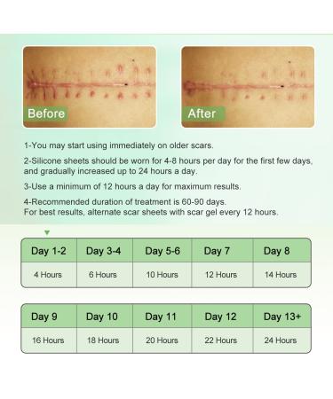 Silicone Scar Sheets Tape Strips 16 Pcs - Keloid C-Section Tummy Tuck Healing - Surgery Scars Treatment - Buy Online on GoSupps.com