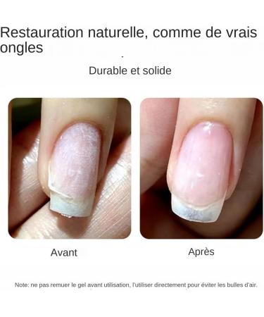 R paration d'Ongles Cass s - Gel Colle - Gel Fortifiant pour Ongles Manucure Quotidien Femmes Filles R paration Fissures Entretien Journalier - Buy Online on GoSupps.com