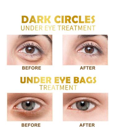 30 Pairs Gold Under Eye Patches with Collagen Treatment for Dark Circles and Wrinkles - Anti-Aging Eye Gel Pads for Women and Men - Buy Online on GoSupps.com