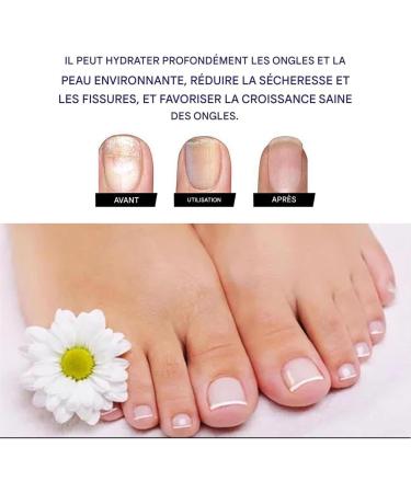  Qkbuza Strengthening and Fortifying Nail Treatment 10ml Smoothing and Strengthening Nail Care Solution Prevents Discoloration and Cracking of Dry and Damaged Nails - Buy Online on GoSupps.com