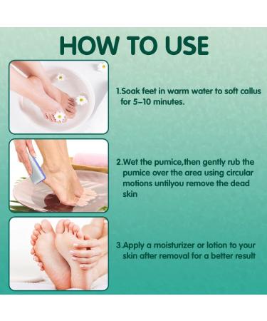 NOVAL 4-in-1 Foot Pumice Stone Set - Callus Remover & Exfoliator Tool for Pedicure (Pack of 4) - Buy Online on GoSupps.com