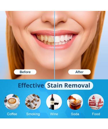 Bledras Teeth Whitening Kit Refill - 10 PCs Professional Tooth Bleaching Gel with LED Light & Soothing Gel - Safe & Effective Whitening - Buy Online on GoSupps.com
