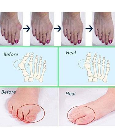 Premium Toe Spreader for Foot Comfort | Correct Alignment & Pain Relief Shop Now! - Buy Online on GoSupps.com