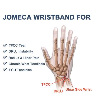 JOMECA Wrist Brace for TFCC Tears and Ulnar Sided Wrist Pain - Support for Carpal Tunnel, Arthritis, DRUJ Instability - Fits Left and Right Hand (S/M) - Buy Online on GoSupps.com