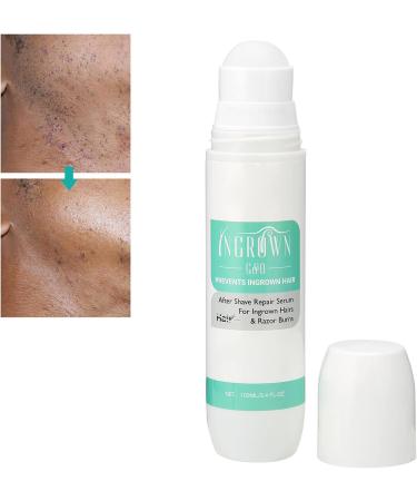 Hair Inhibitor 100ml Roll-on Serum for Ingrown Hair & Razor Bumps | After Shave Repair Solution for Men & Women | Skin Lightening for Bikini Area, Legs & Underarms - Buy Online on GoSupps.com