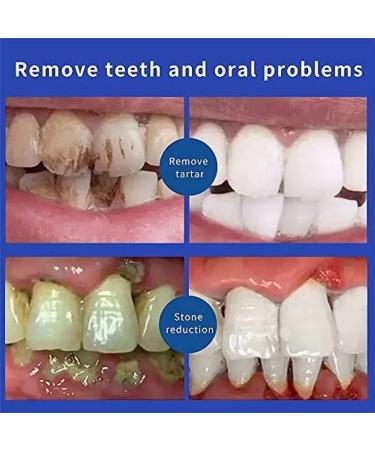 SP-6 Ultra Whitening Toothpaste - Probiotic Brightening Deep Cleaning Prevents Tartar Fresh Breath | International Shipping - Buy Online on GoSupps.com