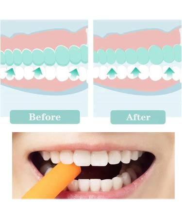 NITAIUN 12-Piece Aligner Tray Set - Chewies & Chompers in 6 Colors for Optimal Dental Alignment | International Shipping Available - Buy Online on GoSupps.com