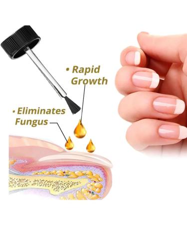 Biancat Onyxoguard Nail Growth and Repair Serum Onyxoguard Nail Serum Nail Growth Serum Nail Growth and Strengthener Nail Strengthener for Thin Nails and Growth (3pcs) - Buy Online on GoSupps.com