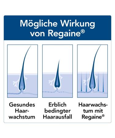 REGAINE Men Foam - Stop Hair Loss & Stimulate Growth | 3 Month Pack with 5% Minoxidil | International Shipping Available - Buy Online on GoSupps.com