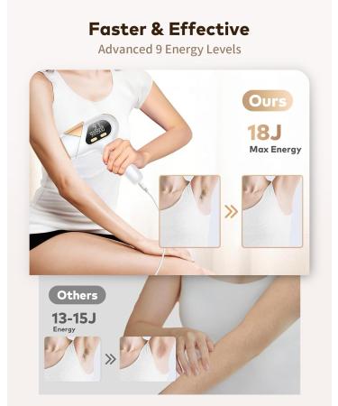 ZKMAGIC IPL Hair Removal Device - 3-in-1 with 9 Energy Levels | Pain-Free Laser Hair Removal for Men & Women | 999 900 Light Impulses | Buy Online Now! - Buy Online on GoSupps.com