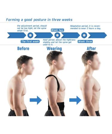 Buy Adjustable Posture Corrector Back Support Brace - Improve Spine Alignment | International Shipping Available - Buy Online on GoSupps.com