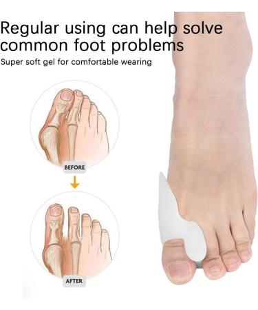 10 Pair Reusable Silicone Bunion Cushion Protector & Toe Separator Set - Buy Online on GoSupps.com