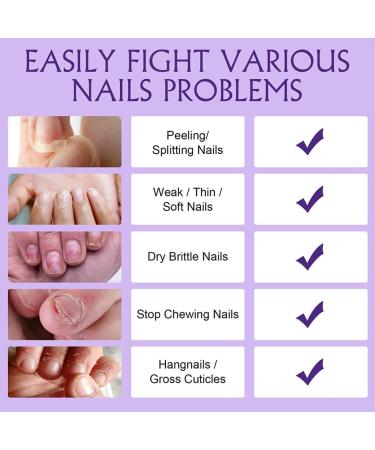  BORN PRETTY Nailive Nail Oil 15ml Cuticle Oil Nail Care Nail Oil Cuticle Cream Cuticle Strengthening Nail Care Kit Cuticle Oil - Buy Online on GoSupps.com