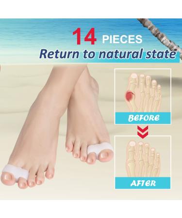 Bunion Corrector 14 Pack for Women Men - Toe Separator Stretchers with Gel Spacers, Hammer Toe Straightener - Bunion Relief & Toe Alignment - Prevent Overlapping Toes, Corns, Blisters - Buy Online on GoSupps.com
