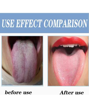 Premium Stainless Steel U-Shaped Tongue Cleaner | Enhance Oral Hygiene | Safe & Comfortable Tongue Scraper - Buy Online on GoSupps.com