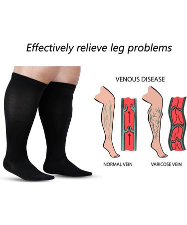 MDGRC Compression Socks for Women & Men - Thick Support Stockings for Calves Thrombosis & Sports - Available in 5XL - Buy Online on GoSupps.com