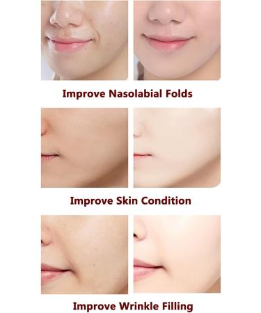 Water Oxygen Jet Beauty Machine Moisturizing Spray Care Instrument with Retract and Memory Functions 3 Steps to Improve Skin Problems for Improve Nasolabial Folds and Dull Skin - Buy Online on GoSupps.com