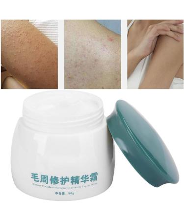 50g Keratosis Pilaris Cream Professional Smoothing Cream Body Chicken Skin Soothing Treatment Body Care Cream Rough Skin Cream Hair Follicle Repairing Chicken Skin Smoothing Body Cream - Buy Online on GoSupps.com