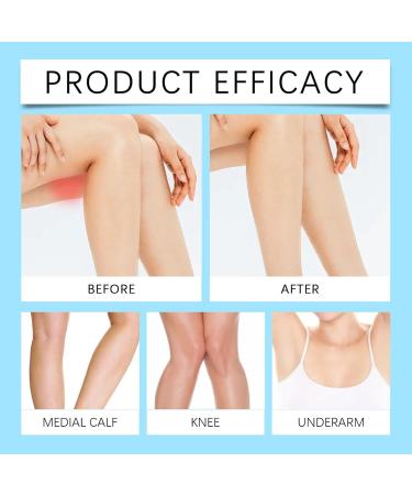 Anti-Chafing Thigh Cream Anti-Chafing Thigh Stick Anti-Chafing Thigh for Women Anti-Friction Cream for Thighs Protection Against Body Skin Friction (3) - Buy Online on GoSupps.com