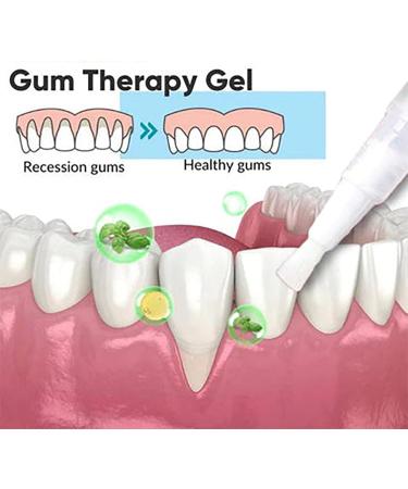 Taileden Gum Therapy Gel - Effective Gum Shield Gel for Oral Health | 3PCs - Buy Online on GoSupps.com