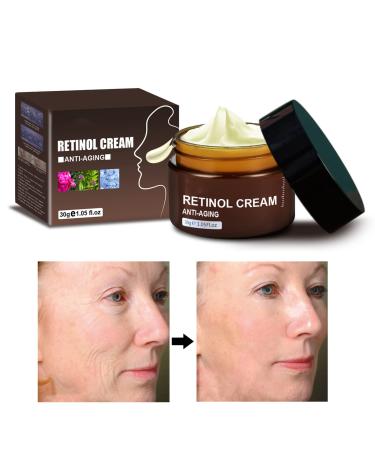 Anti-Wrinkle Face & Neck Retinol Cream with Hyaluronic Acid - Premium Anti-Aging Face Moisturizer - Anti Aging Firming Facial Cream to Reduce Wrinkles Dark Spots Fine Lines Sun Damage