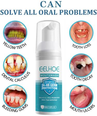 3PCs Teeth Whitening Mouthwash | Removes Calculus & Heals Mouth Ulcers | Freshens Breath and Prevents Cavities | 30ml - Buy Online on GoSupps.com