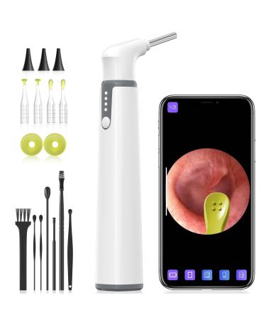 Anykit Wireless Otoscope Ear Camera with Dual View  3.9mm 720PHD WiFi Ear Scope with Ear Wax Removal Tool for Kids and Adults & Pets  Compatible with Android and iPhone