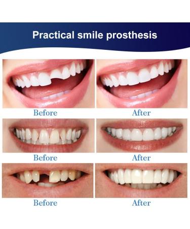 Buy False Teeth Veneers | Immediate Dentures & Cosmetic Tooth Covers | Temporary Prostheses & Artificial Teeth - Buy Online on GoSupps.com