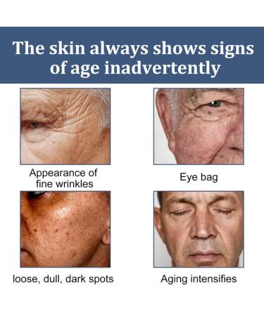 AKARY Men's Face Cream Moisturizer with Aloe Vera - Hydrating 6-in-1 Formula for Dry Skin - Reduce Eye Bags, Fine Lines, and Blackheads - 1.7 oz - Buy Online on GoSupps.com