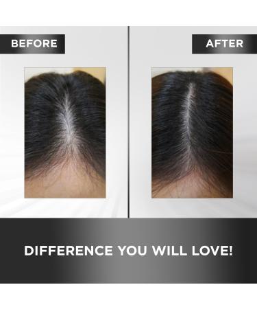 MOEHAIR Hair Guard Tonic | Boost Scalp & Hair Health | Volumizing Argan Oil & Ginseng Formula | Paraben & Sulfate Free | 4 Fl. Oz - Buy Online on GoSupps.com