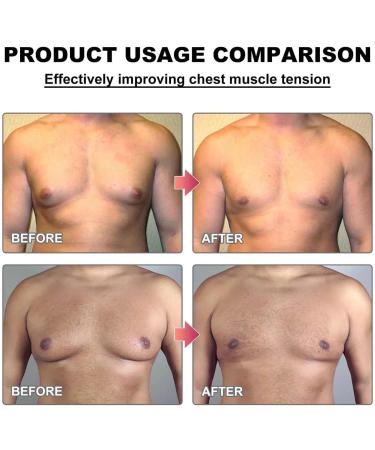 Men Therm Bee Venom Oil | Gynecomastia Heating & Tightening Solution | Reduce Chest Fat & Eliminate Excess Breast Tissue - Buy Online on GoSupps.com